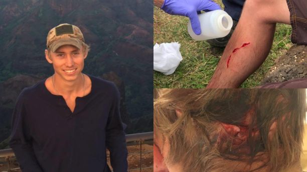 Kauai shark attack victim survived bites from a bear and a 