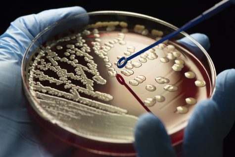 Microorganism on a petri dish.